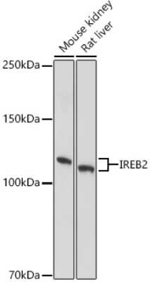 Western Blot: IRP2 AntibodyAzide and BSA Free [NBP3-03393]